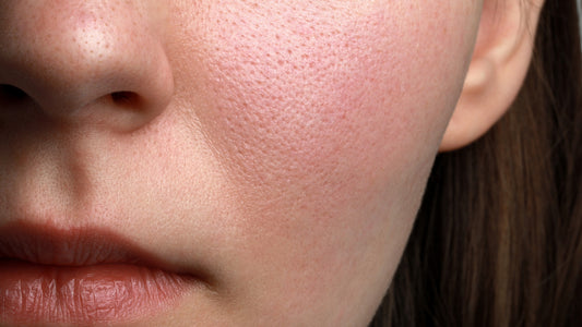 Mastering Facial Skin Texture: Expert Tips & Treatments
