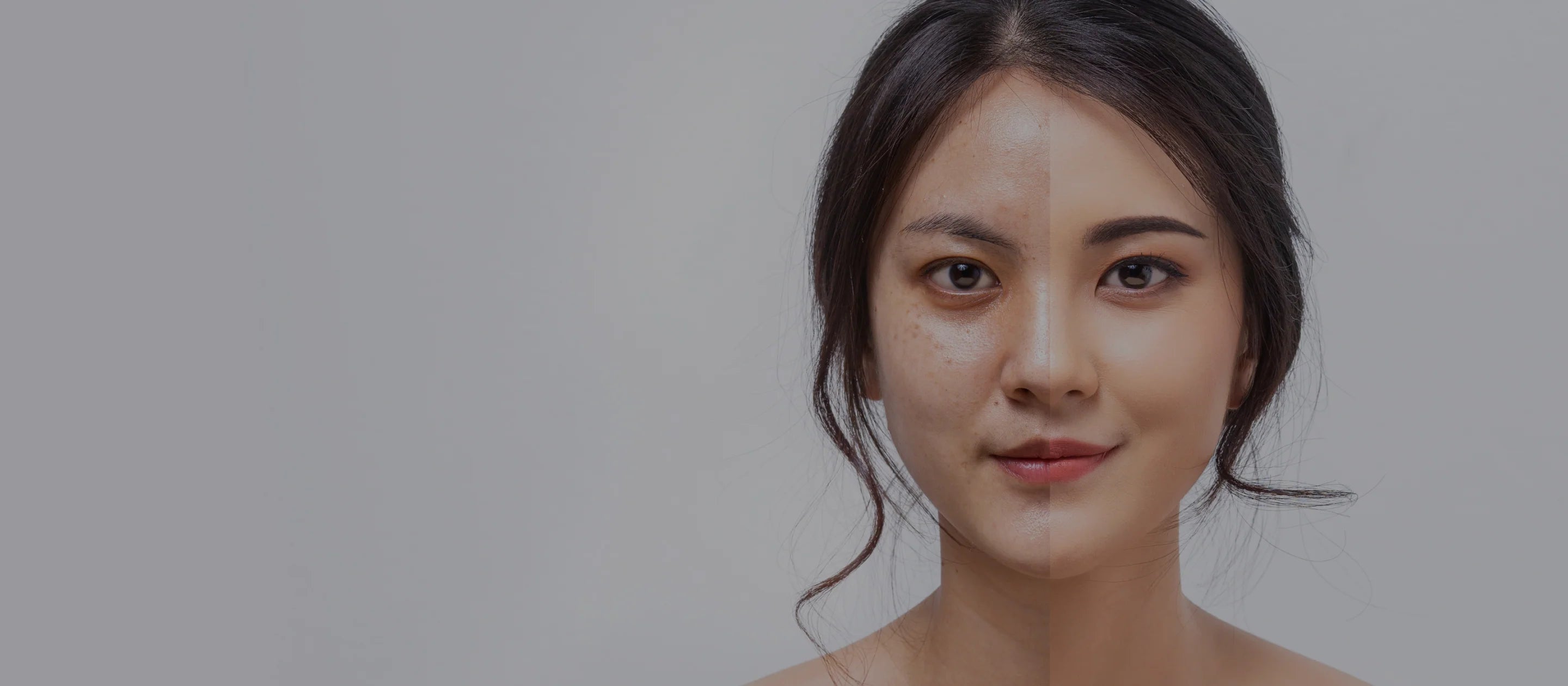 Before & After Skin Treatment