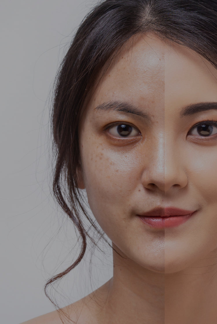 Before & After Skin Treatment