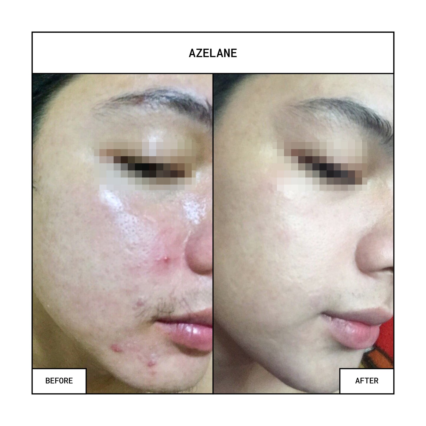 AZELANE Clinical Whitening Soap 100g