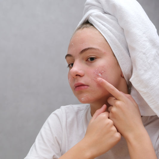 A Step By Step Guide for Building an Acne Fighting Skin Routine