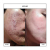 AZELANE Clinical Whitening Soap Bundle 100g x3*
