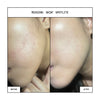 MISSION: SKIN° SpotLite Acne Spot Concentrate 10mL